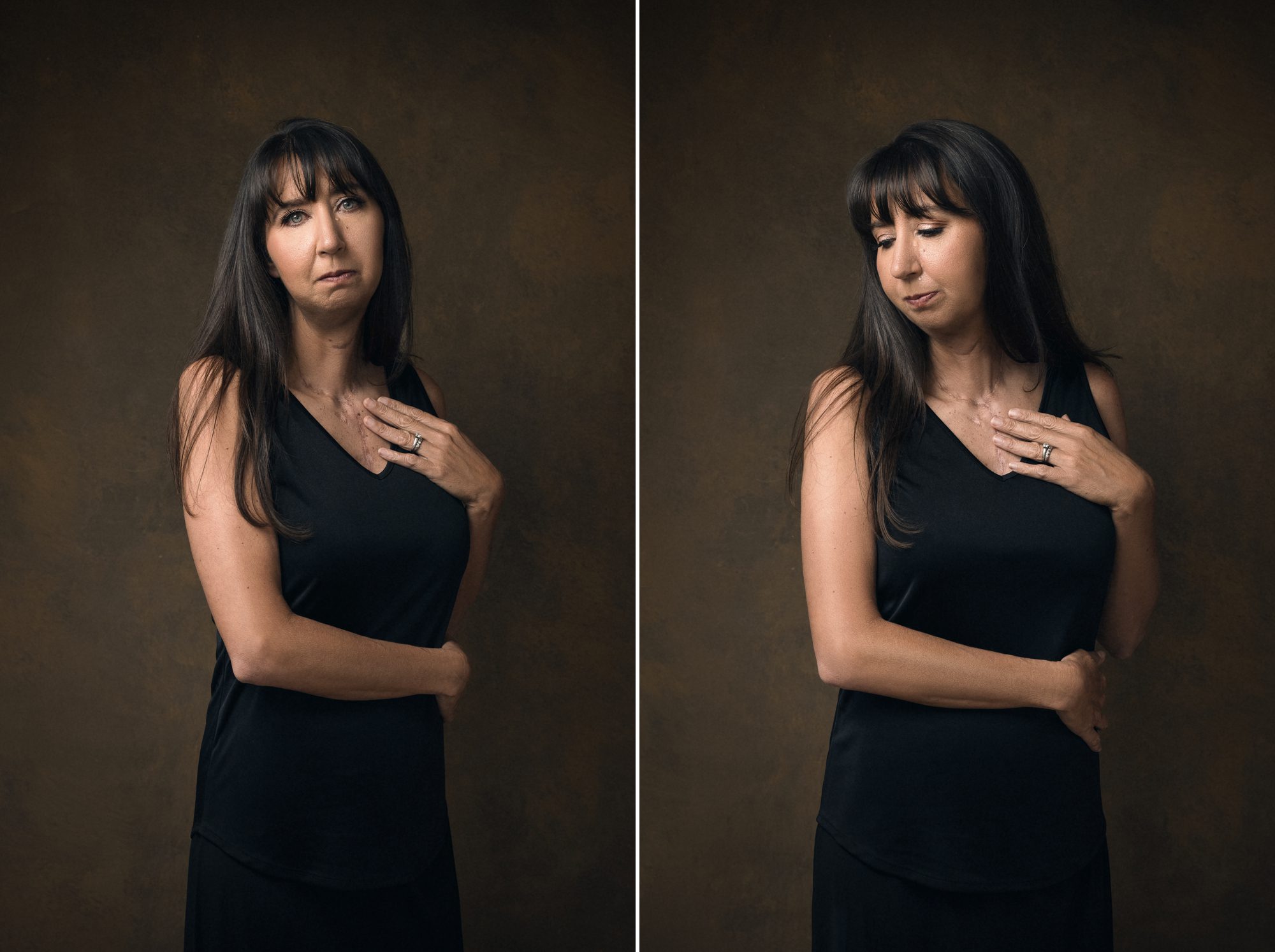 Portrait of a thyroid cancer survivor with scar